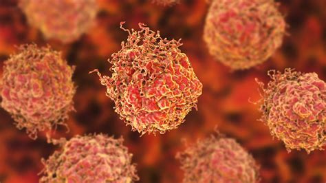 Prostate Cancer Immune System Drug Results Could Be Spectacular Bbc