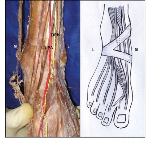 Deep Peroneal Nerve Entrapment Foot Ankle Orthobullet