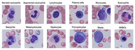 Leukocytes Blood Cells White Blood Corpuscles White