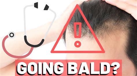 How To Know If Youre Going Bald The Definitive Guide Youtube