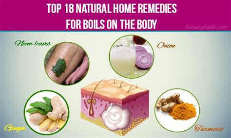 Top 18 Natural Home Remedies For Boils On The Body