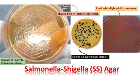 Salmonella Shigella Ss Agar Introduction Composition Principle Pro
