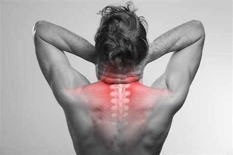 Can Working Out Cause A Pinched Nerve Yashar Neurosurgery Blog