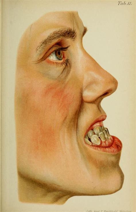 Tumblr Medical Drawings Medical Illustration Dentistry