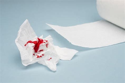 Bleeding Hemorrhoids Piles Itching Why Do Hemorrhoids Bleed For