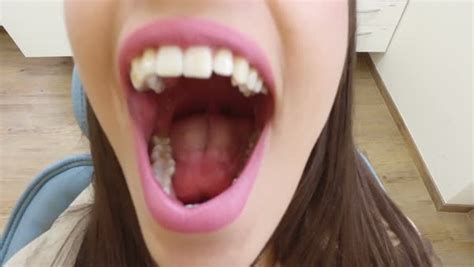 Close Up Of Beautiful Woman With Mouth Wide Open At Dentist Extreme Close Up Of An Open Mouth