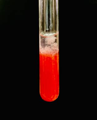 In this lab, you are going to extract the dna from thymus gland nuclei. Grade 11: Strawberry DNA Extraction Lab - BreakingBio