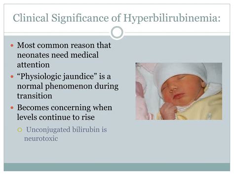 Approach To The Management Of Hyperbilirubinemia In Term
