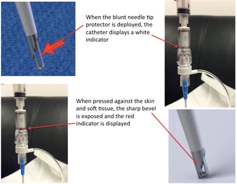 Paracentesis Kit Supplies Pocus Pro And