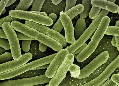 Coli are harmless or cause relatively brief diarrhea. Wat is een bacterie? - Dossier Kinderziekten: van ...
