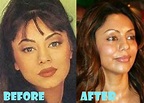 Gauri Khan Plastic Surgery Before and After Pictures - Lovely Surgery