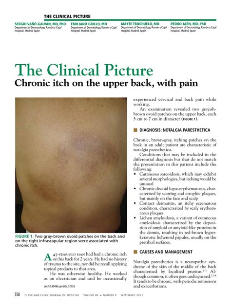Chronic Itch On The Upper Back With Pain Cleveland Clinic Journal Of