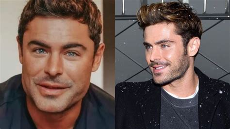 Zac Efron Revela El Fuerte Motivo Por El Cual Se Sometió A Cirugía Facial El Mañana De Nuevo