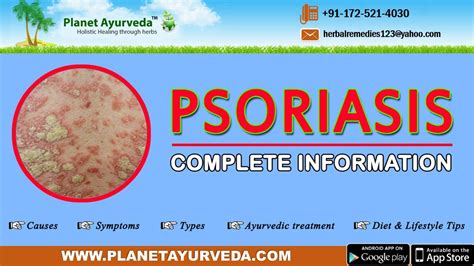 Psoriasis Causes Symptoms Types Ayurvedic Treatment Diet