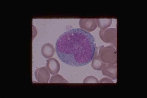 Monocytes