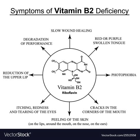 Symptoms Vitamin B2 Deficiency Infographics Vector Image