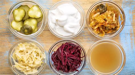 know about the best probiotic foods you can have for a healthy life