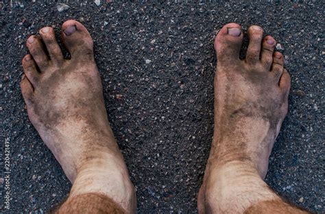 A Man Stands Barefoot With Dirty Feet Dirty Toes Dirty People After