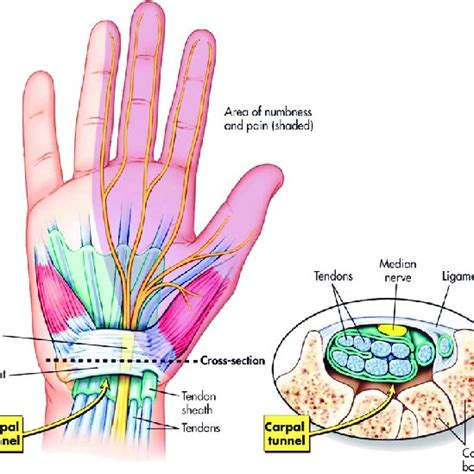 The Carpal Tunnel Reproduced With Permission From Download