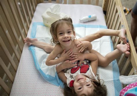 Conjoined Twins Prepare For Separation Surgery At Stanford Hospital The Olympian