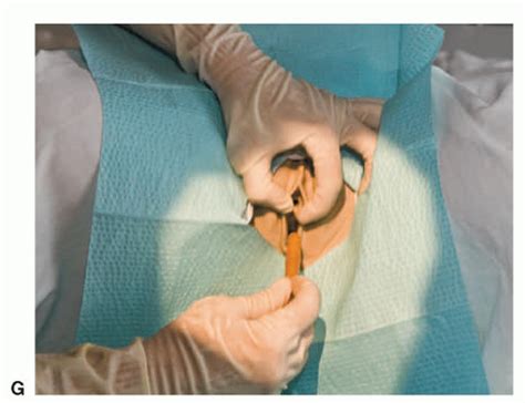 urologic procedures radiology key