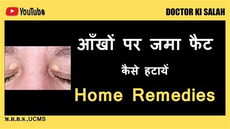 Xanthelasma How To Get Rid Of Eye Fat Home Remedies Youtube