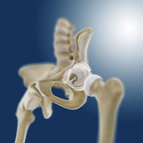 Hip Socket Anatomy Photograph By Springer Medizin Pixels