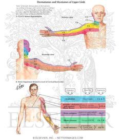 Cervical Radiculopathy And Dermatomes
