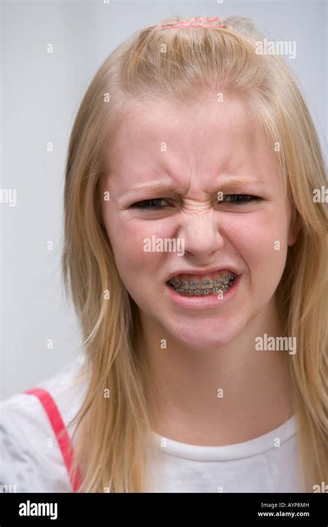 Teenage Girls With Braces Telegraph