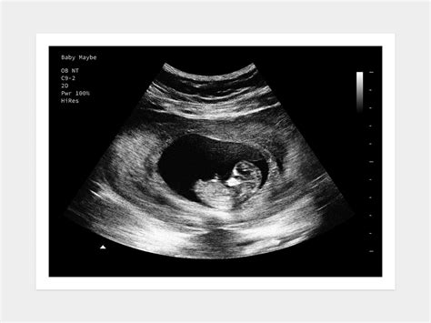 download free fake ultrasound vansminniemouseslides