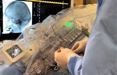Uc Davis Health Launches First Robotic Neurosurgery Program Mirage News