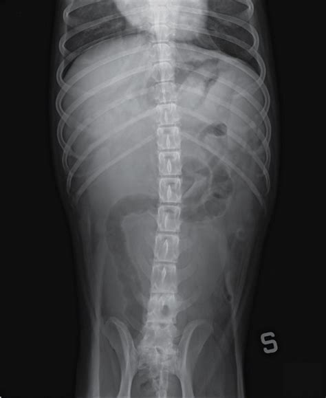 Abdominal Plain Radiographs A Ventrodorsal Projection Showing The
