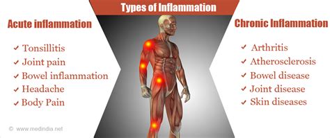 Does Coffee Cause Inflammation In Joints  32 Creative DESIGN Ideas