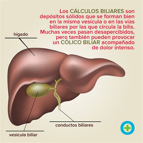 Cuándo operar las piedras en la vesícula