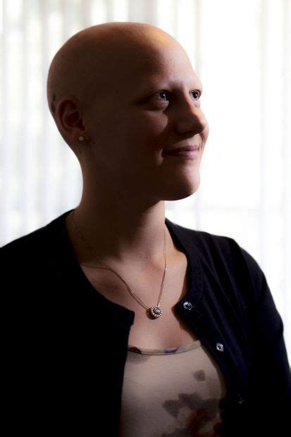 Cindy Lange Kubick Bald And Beautiful A Country Girl With Alopecia