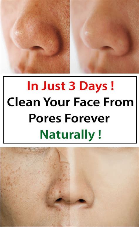 How To Make Pores Disappear With Only 1 Ingredient Naturally Clean