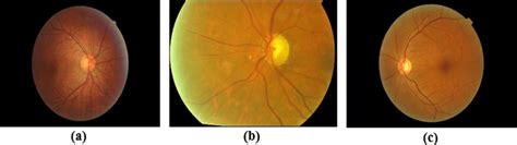 Illustration Of Original Fundus Images From The Collected Datasets A