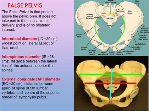 Abnormalities Of Bony Pelvis Online Presentation