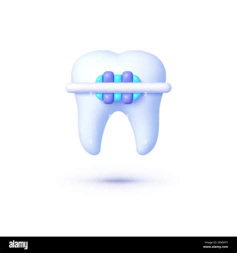Braces Tooth 3d Great Design For Any Purposes Orthodontic Dentistry