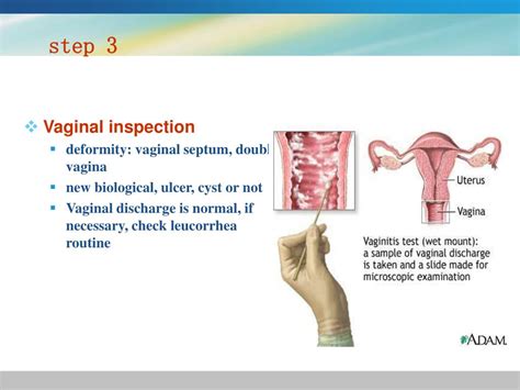 Ppt Gynecological History And Physical Examination Powerpoint Presentation Id4708639