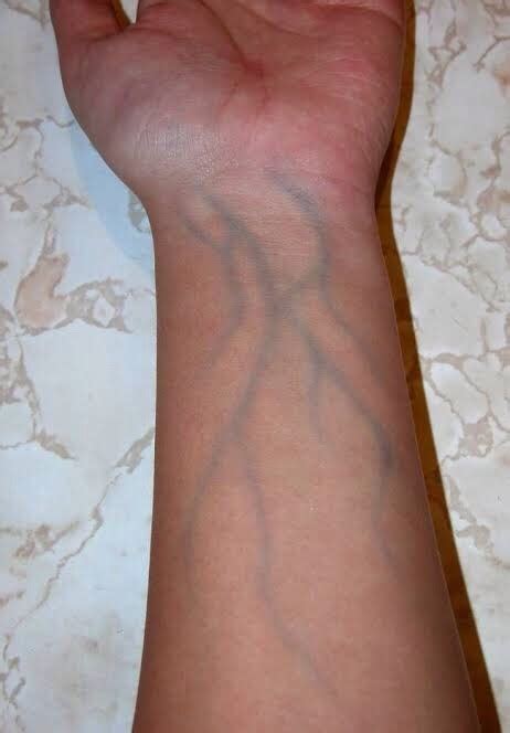 Why Do Veins Look Blue Green From The Outside But When You Extract