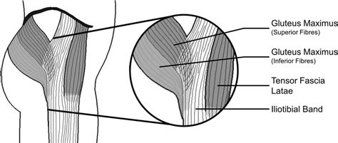 Iliotibial Band Anatomy Showing Insertion Of In Series Muscles Gluteus