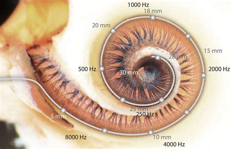 Heres How The Ear Hears Sound With Tens Of Thousands Of Hair Cells