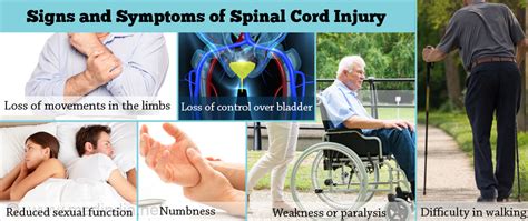 Spinal Cord Injury Causes Symptoms Diagnosis Treatment And Prevention
