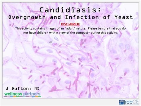 Candidiasis Overgrowth And Infection Of Yeast Youtube