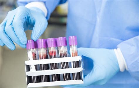 Blood Test Could Predict Future Risk Of Blood Cancer