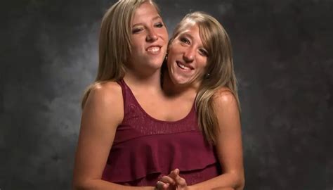 Rare Conjoined Twins Abby And Brittany Share Their Exciting News With