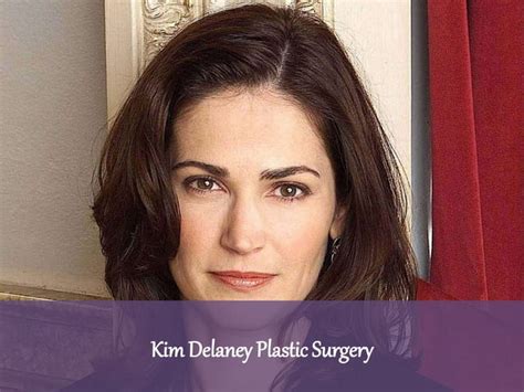 Kim Delaney Plastic Surgery Ppt