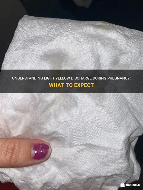 Understanding Light Yellow Discharge During Pregnancy What To Expect