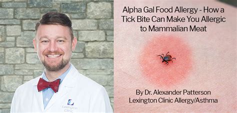 Alpha Gal Food Allergy How A Tick Bite Can Make You Allergic To